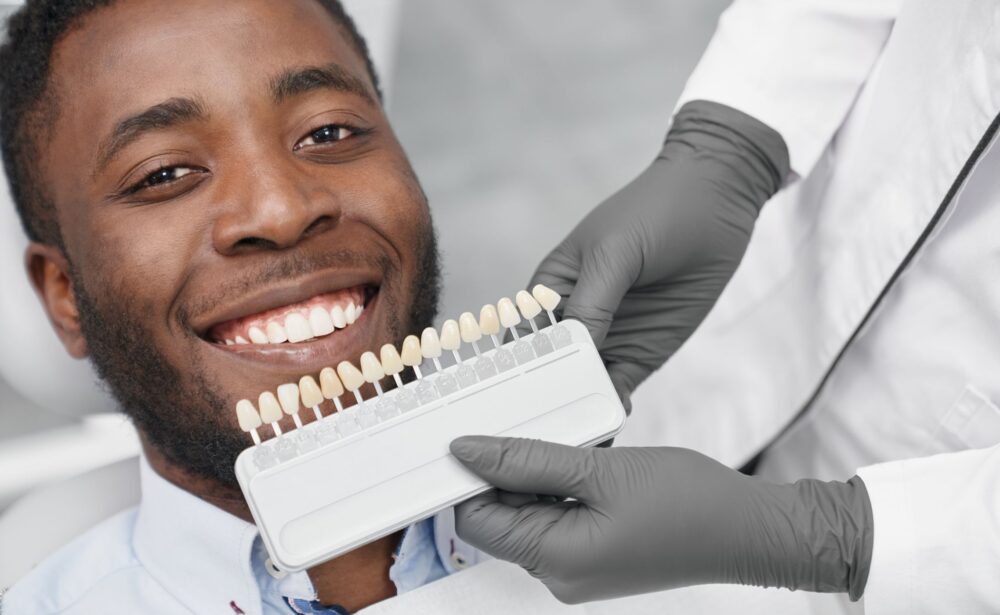 veneers in lagos